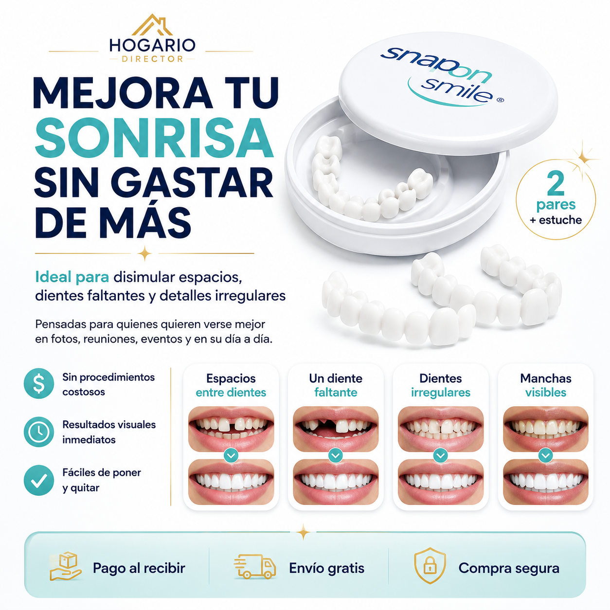 Sonrisa Viva™ | Carillas Dentales Estéticas de Apariencia Natural