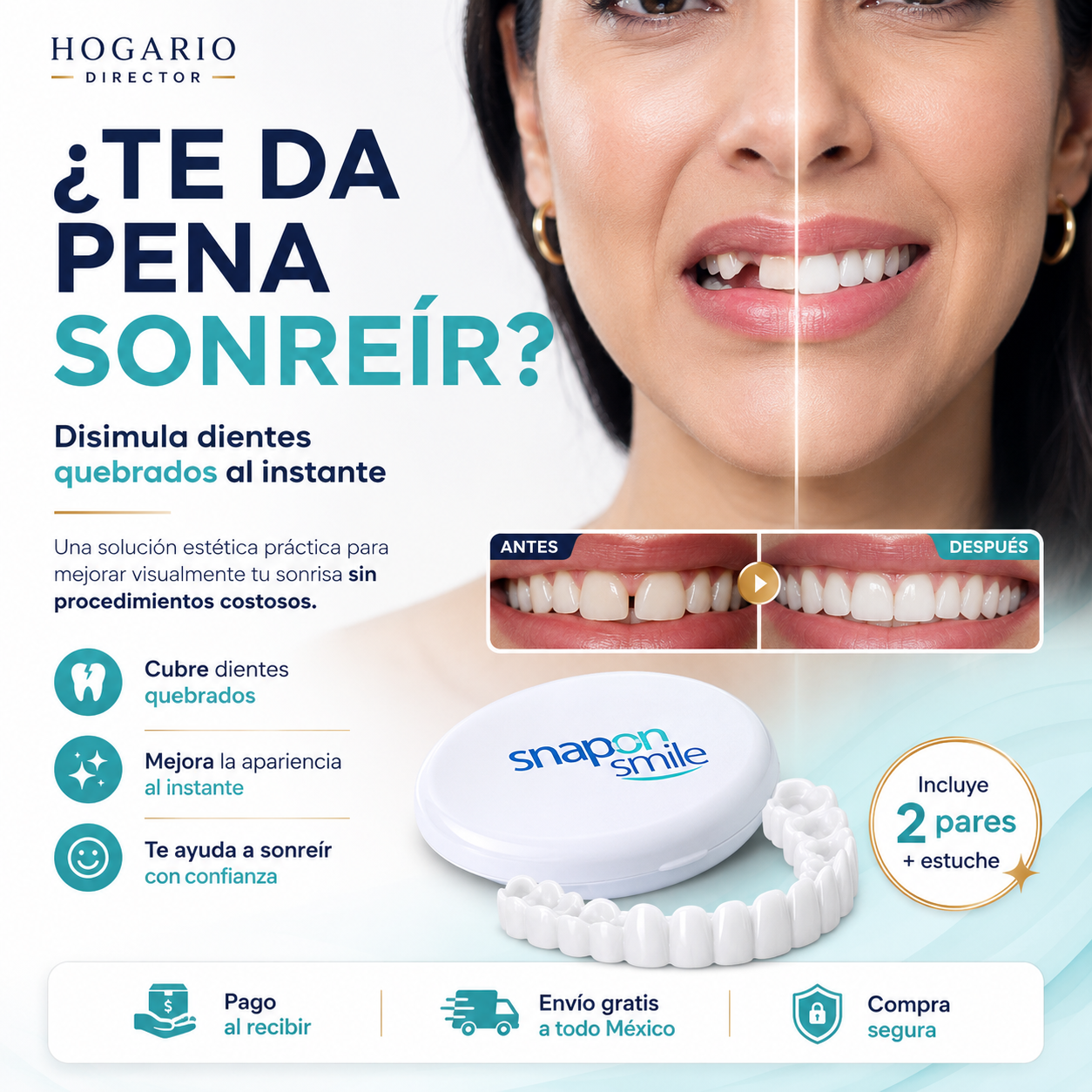 Sonrisa Viva™ | Carillas Dentales Estéticas de Apariencia Natural