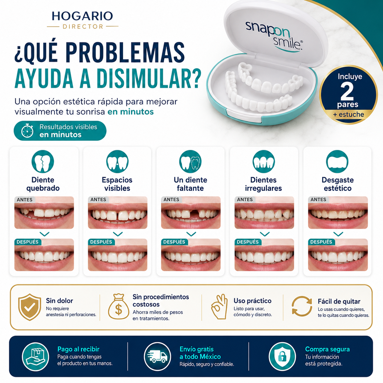 Sonrisa Viva™ | Carillas Dentales Estéticas de Apariencia Natural